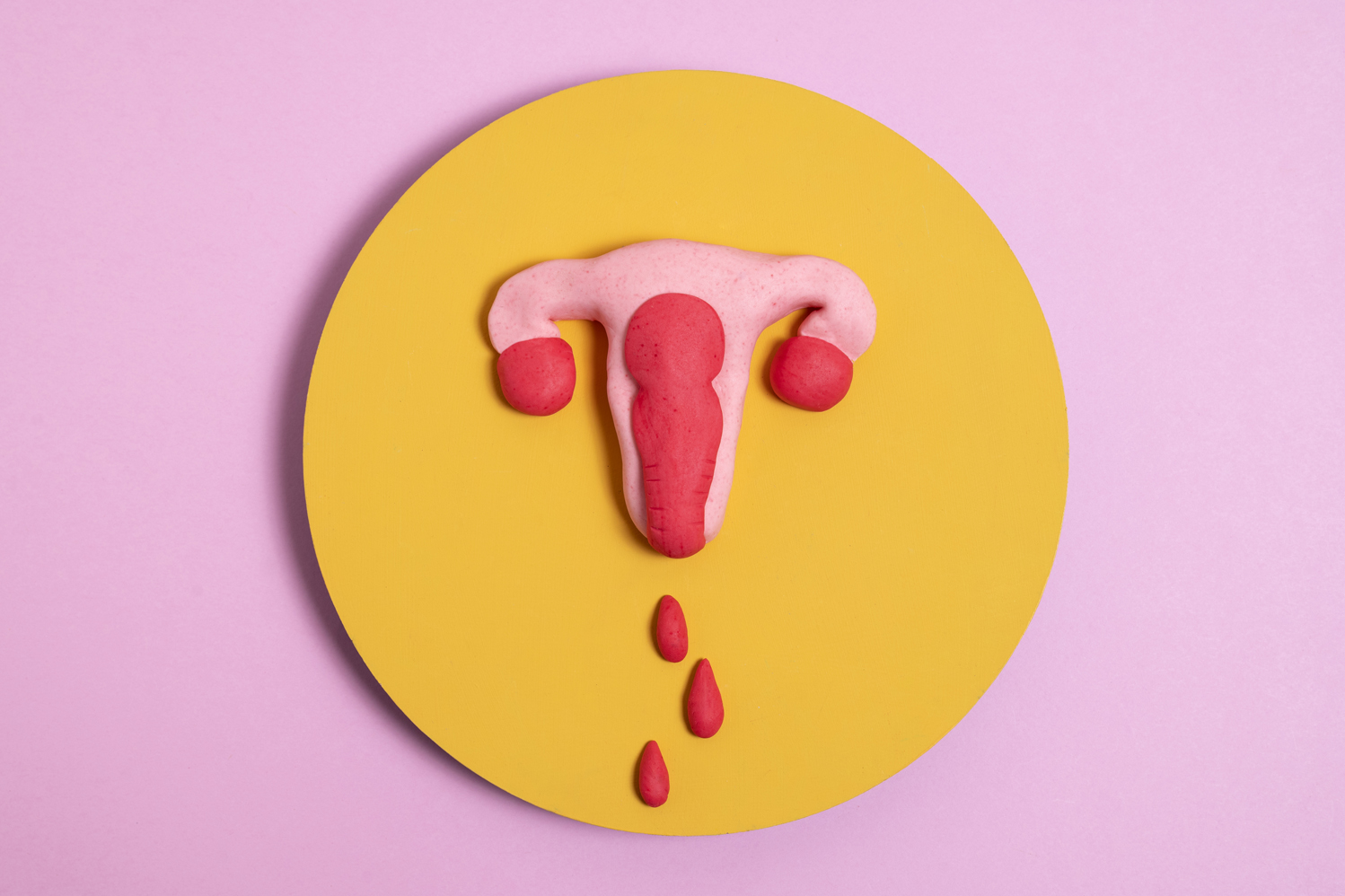 Nem todo sangramento vaginal está relacionado à menstruação.